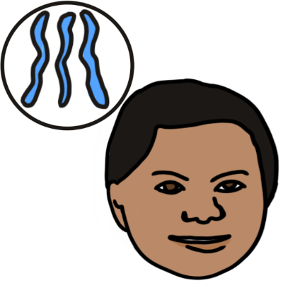 three blue chromosones in a white circle, and the face of a person with Down syndrome, who is smiling slightly. the person has light brown skin and dark hair.